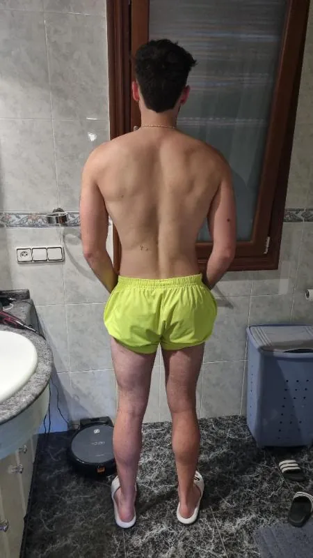 Sebas, espalda después del proceso