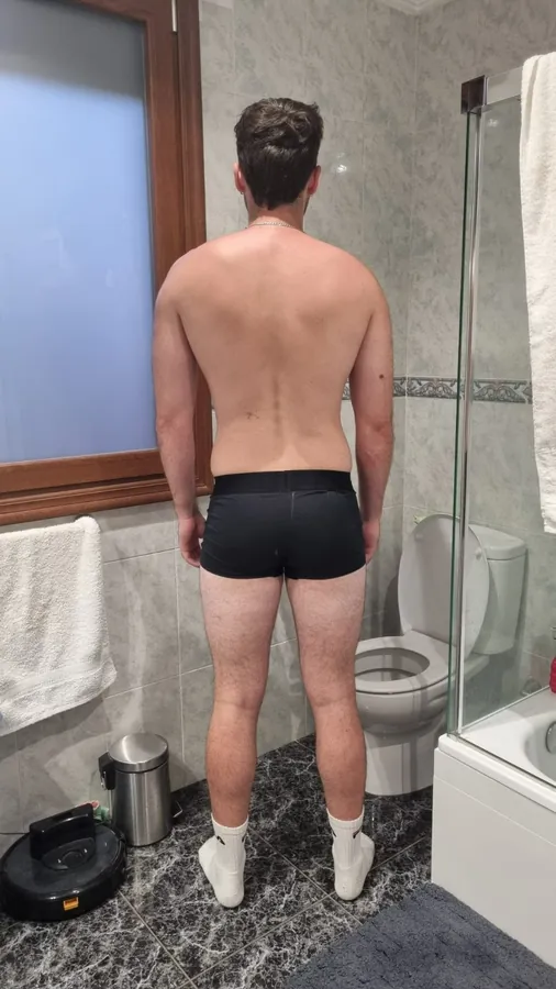 Sebas, espalda antes del proceso